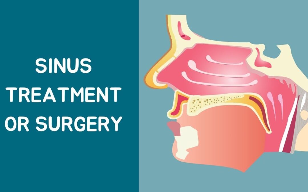 Sinus Treatment or Surgery? What a Sinus Doctor Recommends